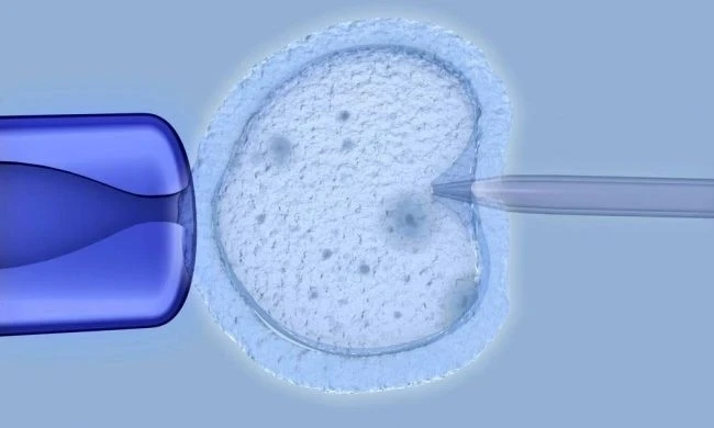 Mini IVF (Minimal Stimülasyon Tüp Bebek) Nedir?