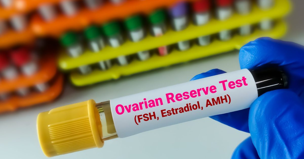 AMH Testi Nedir? Yumurtalık Rezervi Nasıl Ölçülür?