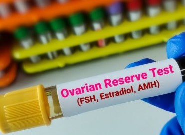 AMH Testi Nedir? Yumurtalık Rezervi Nasıl Ölçülür?