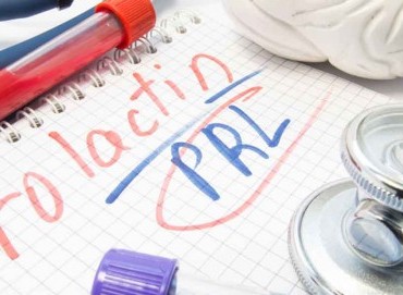 Hiperprolaktinemi Nedir? Kısırlıkla İlişkisi