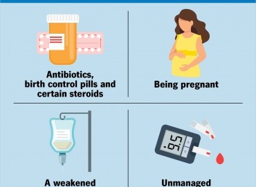 Vajinal Enfeksiyonlar: Yaygın Türleri ve Önleme Yöntemleri