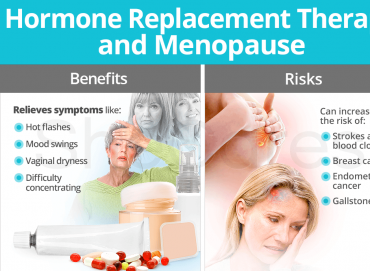 Menopoz Döneminde Hormon Tedavisi: Avantajlar ve Riskler