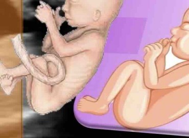 IUGR Nedir? Bebekte Büyüme Geriliği ve Takibi
