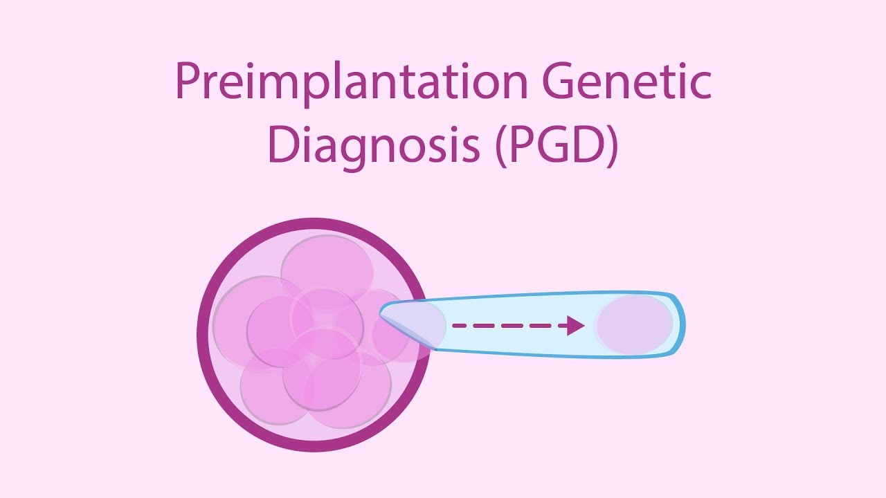 Preimplantasyon Genetik Tanı (PGT) Nedir? Kimler İçin Uygundur?
